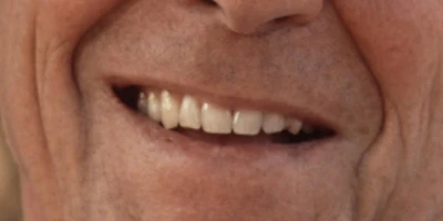 Glimlag